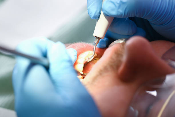 Best After-Hours Emergency Dentist in Lincolnton, GA