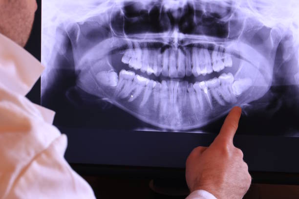 Best Emergency Root Canal Treatment in Lincolnton, GA